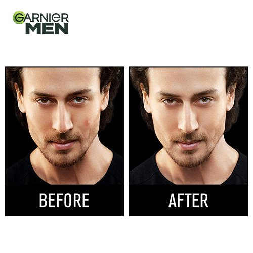 Garnier Men Acno Fight Anti Pimple Face Wash - Before After Image